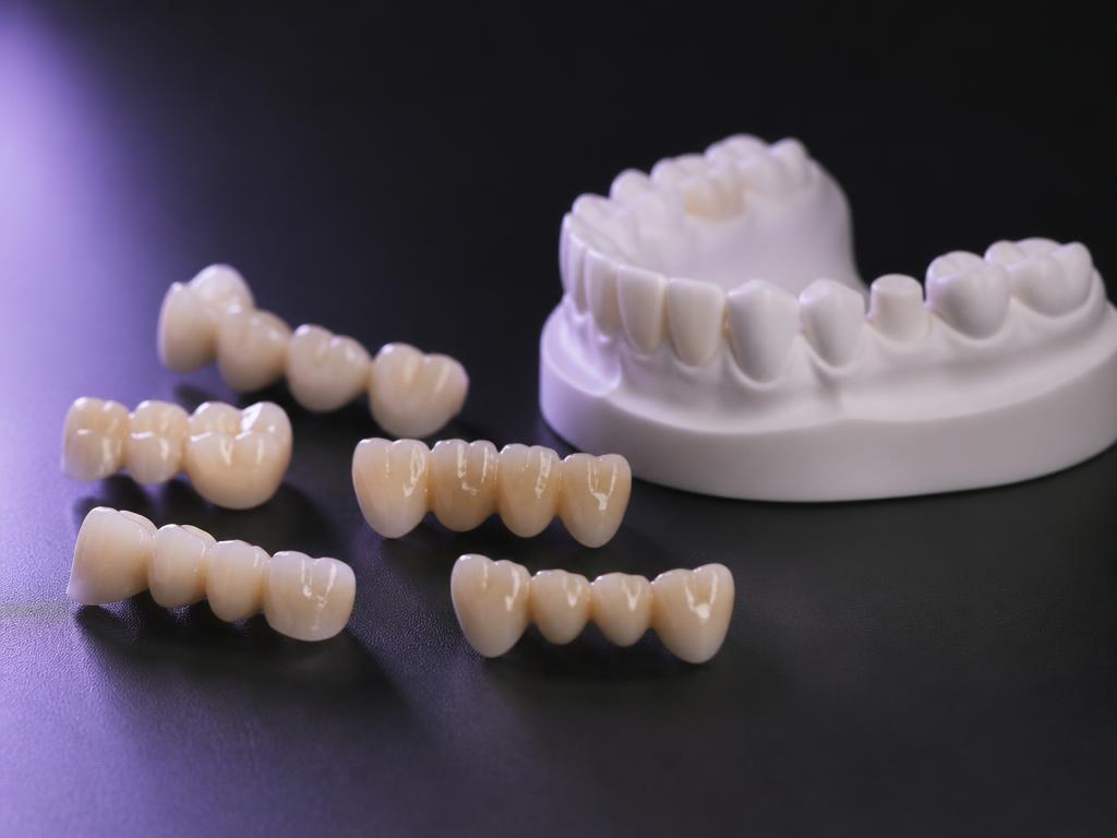 Provisórios impressos em 3D ao lado de modelo de arcada